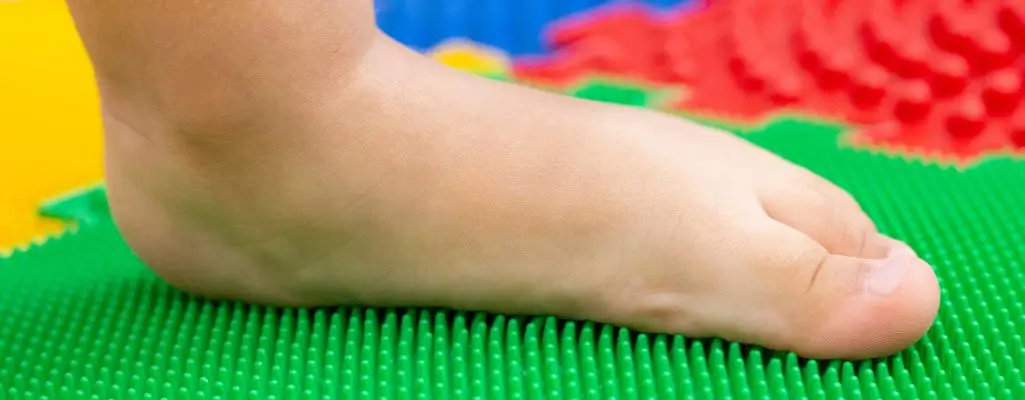 Płaskostopie u dzieci. Jak je rozpoznać i leczyć? 1 Obrazek wyróżniający do artykułu płaskostopie u dzieci. Widoczna stopa dziecka z wadą w postaci płaskostopia znajdująca się na macie